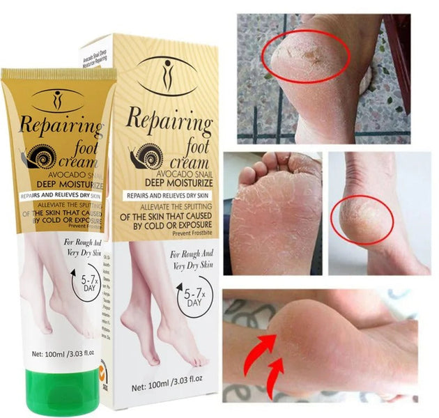 Aichun Beauty Repairing Foot Cream