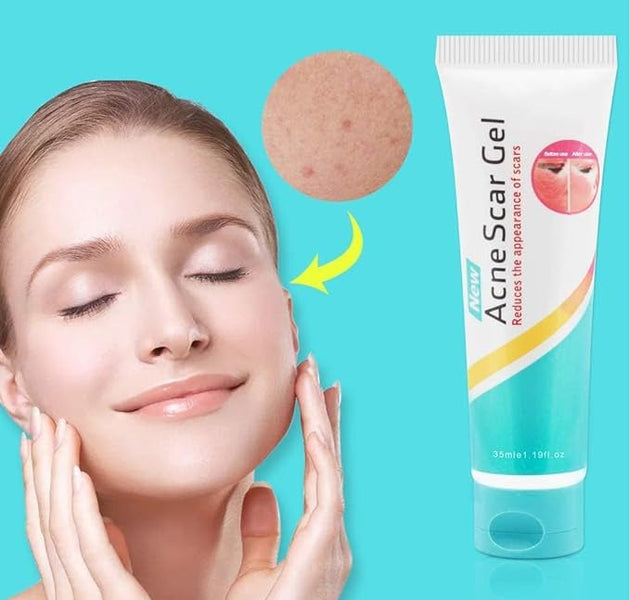 Acne Scar Gel